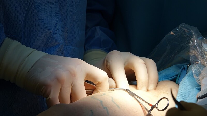 The Psychology Behind Cosmetic Enhancement Decisions
